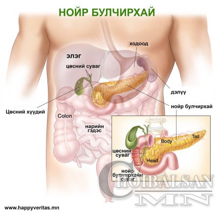 Нойр булчирхай хүндэрвэл 5-6 сар л амьдардаг