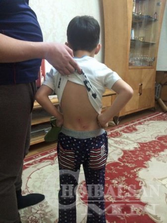 “Говь хангай мебель”-ийн шинэхэн тавилага нурж хэрэглэгчээ гэмтээжээ