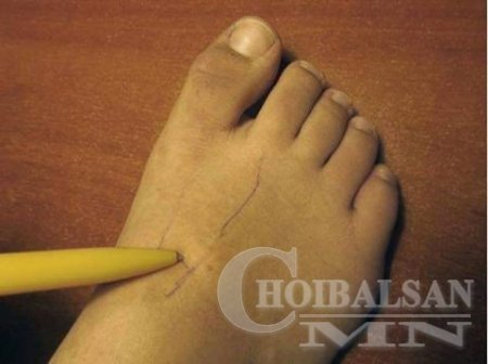 ГАНЦХАН ЦЭГ ДЭЭР ДАРЖ ДАРАЛТЫГ БУУРУУЛЖ БОЛНО