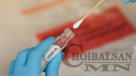 Жирэмсэн эмэгтэй, 65-аас дээш насныхныг PCR шинжилгээнд үнэ төлбөргүй хамруулна