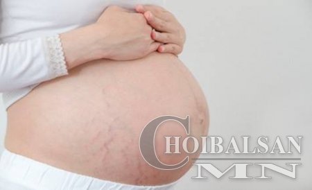Язралтыг гэрийн аргаар 6 долоо хоногт арилгах боломжтой