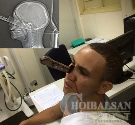 Дүүгийнхээ хамарлуу хутга зоожээ \+18\