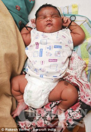 6 кг жинтэй аварга хүүхэд мэндэллээ