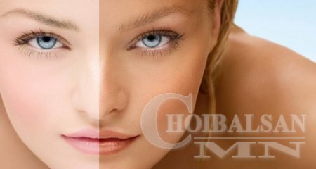 Наранд борлож, түлэгдсэн арьсыг цайруулж эмчлэх 7 арга