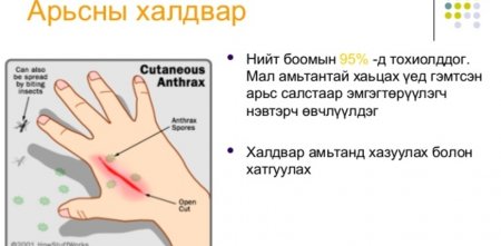 ТОГООЧ ЭМЭГТЭЙД МАЛЫН ГОЦ ХАЛДВАРТ БООМ ӨВЧНИЙ ШИНЖ ТЭМДЭГ ИЛЭРЧЭЭ