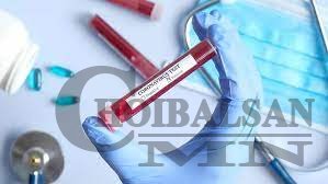 Дорнод аймаг ногоон бүс хэвээрээ байна