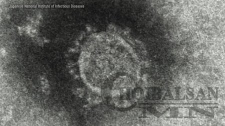 “COVID-19”-өөр халдварласны дараа урт хугацаанд илэрсэн зовууриудыг нэрлэжэ ...